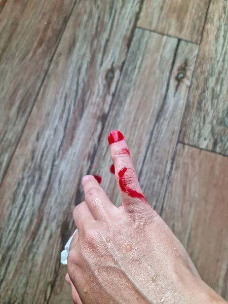 Véletlenül Megvágta Ujját Vér Teletömte Kezét Földre Csöpögött Rizs Főzés — Stock Fotó