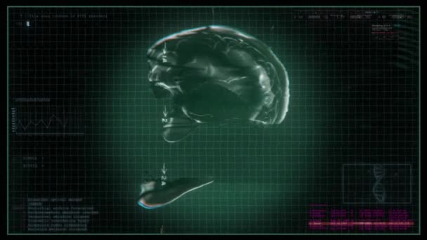 Οθόνη Δεδομένων Ιατρικού Τύπου Που Δείχνει Ένα Ανθρώπινο Κεφάλι Ψηφιακό — Αρχείο Βίντεο