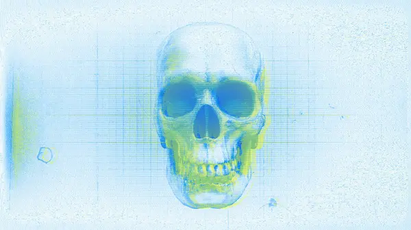 stock image Old film and medical chart style graphic of a skull with a grunge effect.