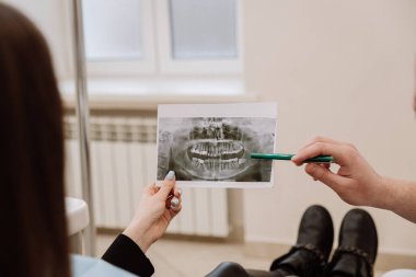 Modern bir klinikte muayene sırasında bir hastaya diş röntgeni açıklayan bir diş hekimi. Yüksek kalite fotoğraf