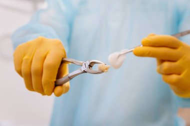 Diş hekiminin steril aletler ve eldivenlerle klinik ortamda diş çekişini kapat. Yüksek kalite fotoğraf