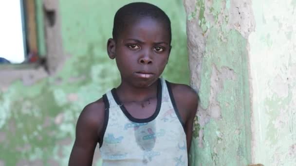 Gennaio 2024 Gwalada Nigeria Bambino Malnutrito Causa Della Povertà Estrema — Video Stock