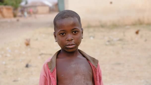 Jan 2024 Gwalada Nigeria Malnourished Child Due Extreme Poverty Hunger — Stock Video