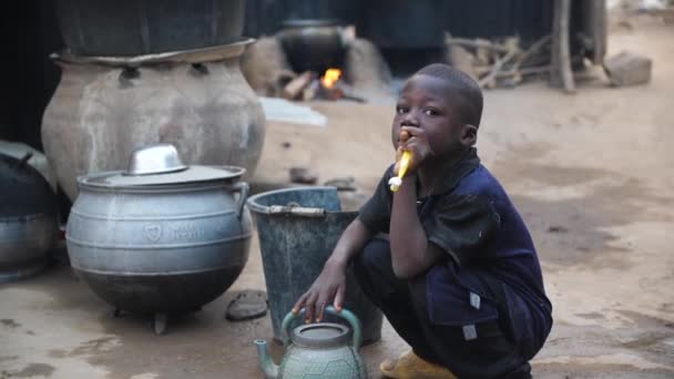 Jan 2024 Gwalada Nigeria Enfant Souffrant Malnutrition Raison Extrême Pauvreté — Video