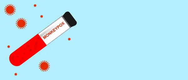 Açık mavi zemin üzerinde virüs parçacıkları ile çevrili kırmızı sıvı Maymun Çiçeği ile test tüpü.