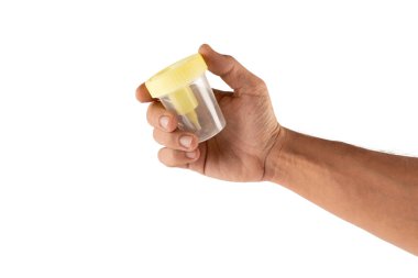 Beyaz arka planda izole edilmiş idrar testi plastik kavanozu tutan bir erkek el. Yüksek kalite fotoğraf