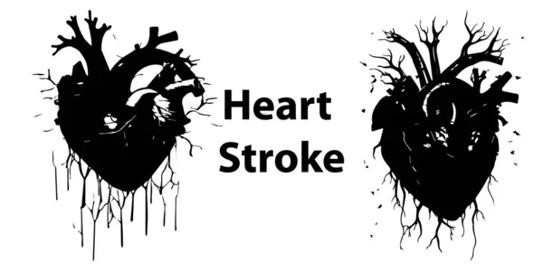 Órgão Cardíaco Com Linhas Pretas — Vetor de Stock