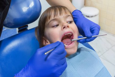 Diş muayenesi sırasında ağzını açan küçük bir kızın yakın çekimi..