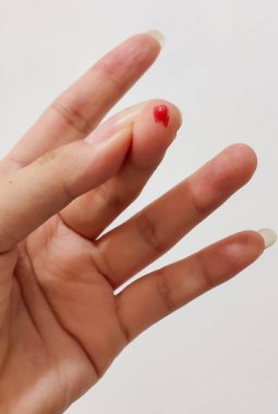 Kan şekerini ölçmek için küçük bir iğne batırıldıktan sonra orta parmakta bir kan lekesi belirir. Sağlık ve sağlık faaliyetleri için uygun.