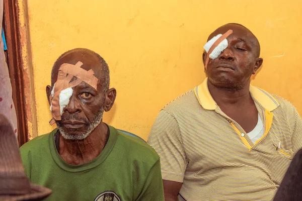 stock image Abuja, Nigeria - December 25, 2021: Middle-aged African people Diagnosed of Cataract in the eye and Prepared for Surgery