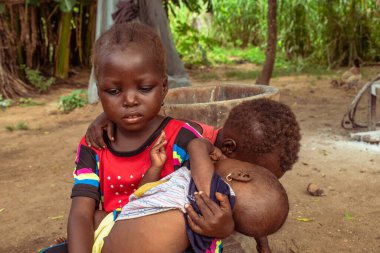 Opialu, Benue State, Nijerya - 6 Mart 2021: Afrikalı Kardeşler Tıbbi Yardım Arıyor