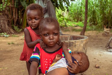 Opialu, Benue State, Nijerya - 6 Mart 2021: Afrikalı Kardeşler Tıbbi Yardım Arıyor