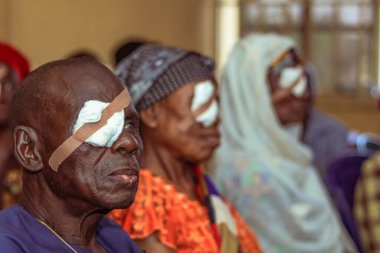 Abuja, Nijerya - 25 Aralık 2021: Orta yaşlı Afrikalılar Katarakt teşhisi kondu ve ameliyata hazırlandılar
