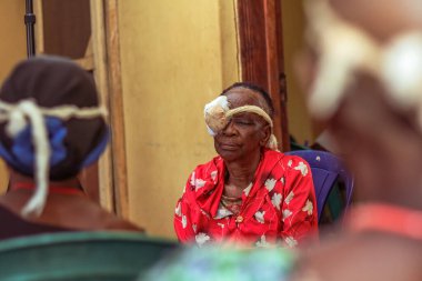 Abuja, Nijerya - 25 Aralık 2021: Orta yaşlı Afrikalılar Katarakt teşhisi kondu ve ameliyata hazırlandılar
