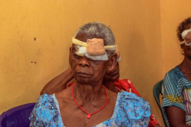 Abuja, Nijerya - 25 Aralık 2021: Orta yaşlı Afrikalılar Katarakt teşhisi kondu ve ameliyata hazırlandılar