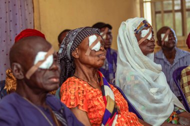 Abuja, Nijerya - 25 Aralık 2021: Orta yaşlı Afrikalılar Katarakt teşhisi kondu ve ameliyata hazırlandılar