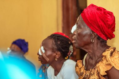 Abuja, Nijerya - 25 Aralık 2021: Orta yaşlı Afrikalılar Katarakt teşhisi kondu ve ameliyata hazırlandılar