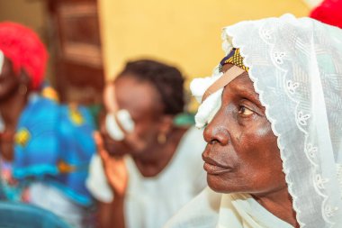 Abuja, Nijerya - 25 Aralık 2021: Orta yaşlı Afrikalılar Katarakt teşhisi kondu ve ameliyata hazırlandılar