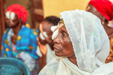 Abuja, Nijerya - 25 Aralık 2021: Orta yaşlı Afrikalılar Katarakt teşhisi kondu ve ameliyata hazırlandılar