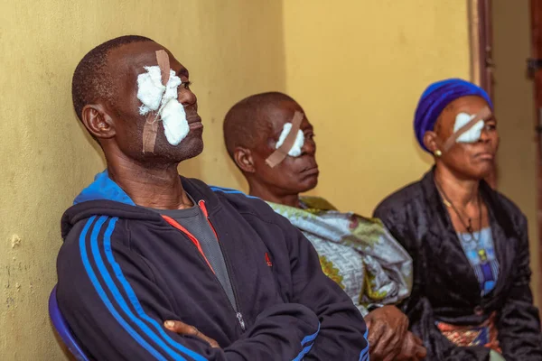 Abuja Nigeria Joulukuuta 2021 Keski Ikäiset Afrikkalaiset Diagnosoitu Kaihi Silmässä — kuvapankkivalokuva