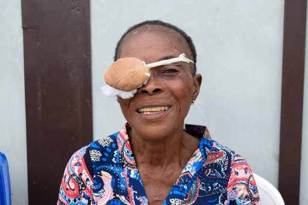Abuja Nigeria Agosto 2021 Agli Africani Diagnosticata Cataratta Negli Occhi — Foto Stock