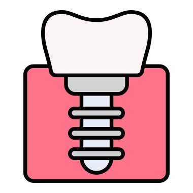 Diş implantı vektör simgesi. Yazdırma, mobil ve web uygulamaları için kullanılabilir.
