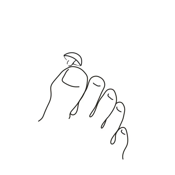 Ілюстрація Чорне Білому Малюнок Ноги Грибком Білому Тлі Використання Галузі — стокове фото