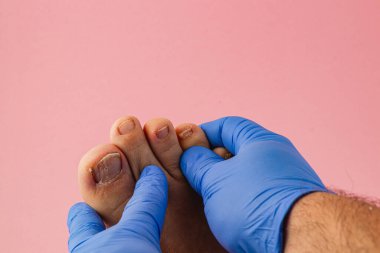 Bir sağlık uzmanının ayak parmaklarını nazikçe muayene etmesi ve tedavi etmesi gibi. Bu bilgilendirici oturum yumuşak pembe bir arkaplan üzerinde gerçekleşir.