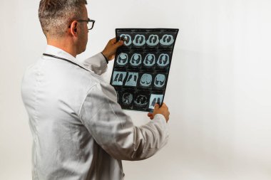 Laboratuvar önlüklü bir doktor bir dizi göğüs röntgeni üzerinde çalışıyor, sağlık durumlarını belirlemeye odaklanmış. Tıbbi değerlendirmeyi vurgulayan arka plan sade..