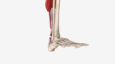 Yırtık Aşil Tendonlu Esneme ve Uzatma .