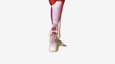 Yırtık Aşil Tendonlu Esneme ve Uzatma .