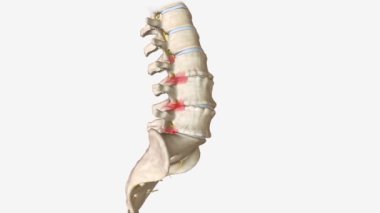 Dejeneratif disk hastalığı aslında bir hastalık değil, hasarlı bir diskin ağrıya neden olduğu bir durumdur. .