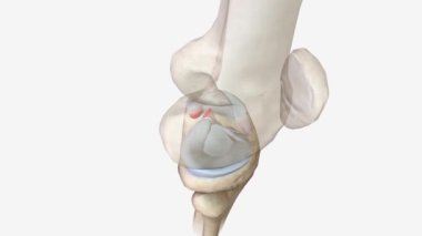 Meniskal kök gözyaşları meniskal vücut yırtıklarından daha az yaygındır ve sık sık fark edilmezler..