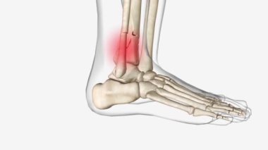 Uzun Kemikler 'in 3 boyutlu tıbbi bileşimi