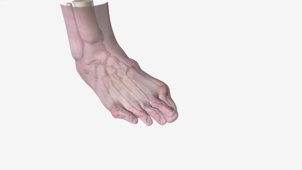 Bunions Overlapping Toes Medical — Stock Video