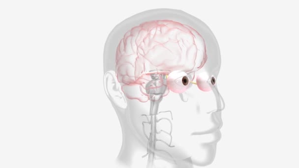 Zapalenie Nerwu Wzrokowego Występuje Gdy Obrzęk Zapalenie Uszkadza Nerw Wzrokowy — Wideo stockowe