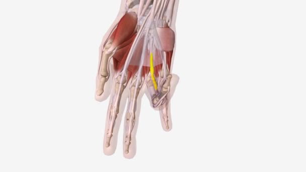 Dupuytren Ist Contracture Central Cord — Stockvideo