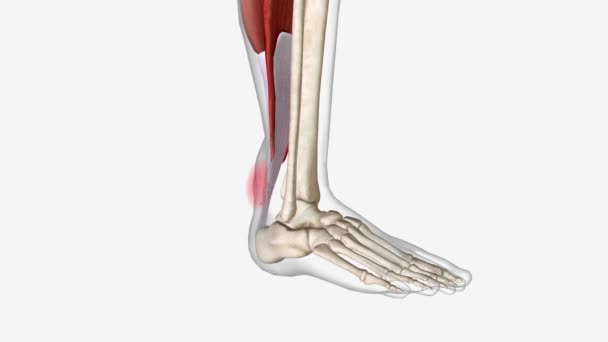 足首の痛みの症状 株の部位に局在する腫れ — ストック動画