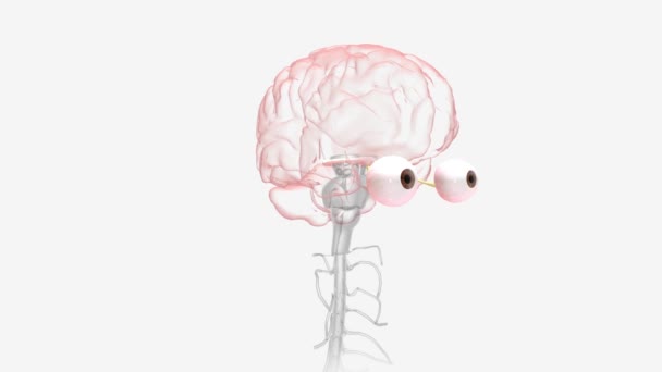 Optisk Neurit Uppstår När Svullnad Inflammation Skadar Synnerven — Stockvideo