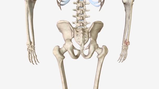 Переломи Тип Розбитої Кістки — стокове відео