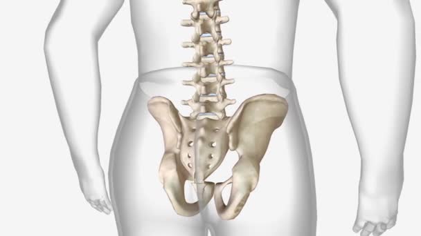 脊椎の関節や靭帯に炎症を引き起こす関節炎の一種です — ストック動画