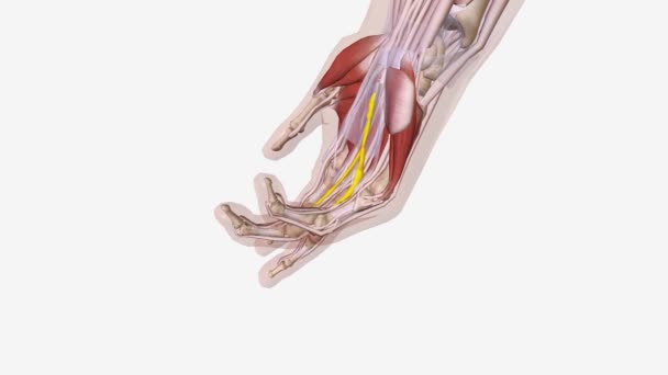 Dupuytren Ist Contracture Multicord — Stockvideo