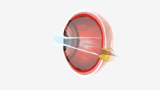 Astigmatism is a type of refractive error. Astigmatism occurs when the cornea or lens is curved more steeply in one direction than in another.