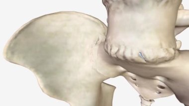 Spondylitis omurları arasında omurilik erimesi .