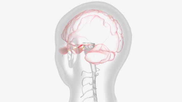 Оптический Неврит Возникает Отек Воспаление Повреждает Зрительный Нерв — стоковое видео