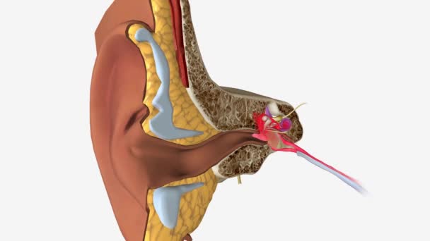 内耳感染会使你的内耳部分发炎或发炎 — 图库视频影像