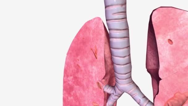 Akciğerler Koronal Çapraz Bölüm Sağ Üst Lob — Stok video