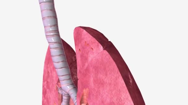 Akciğerler Koronal Çapraz Sol Alt Lob — Stok video