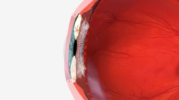 Córnea Parte Frontal Transparente Del Ojo Que Cubre Iris Pupila — Vídeo de stock