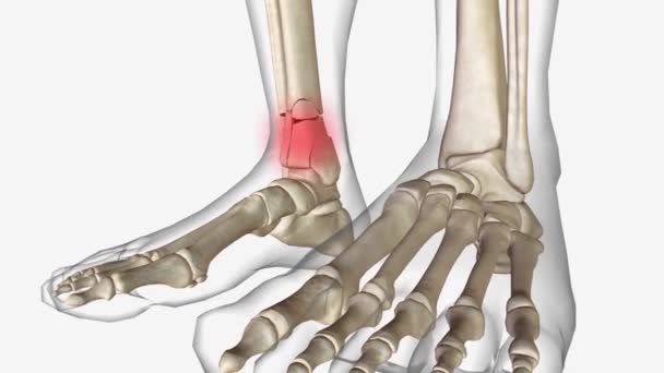 Composición Huesos Largos Médico — Vídeos de Stock